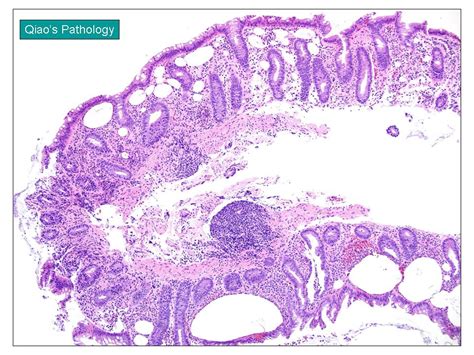 Intestinalis! A Microscopic Wonder Living a Life of Perpetual Feasting